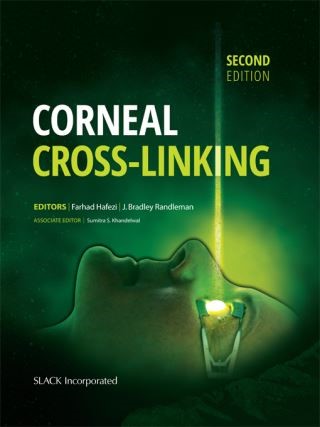 Corneal Cross-Linking, Second Edition Cover Image