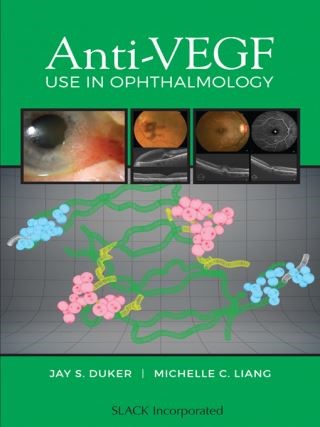 Anti-VEGF Use in Ophthalmology Cover Image