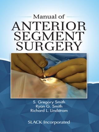 Manual of Anterior Segment Surgery Cover Image
