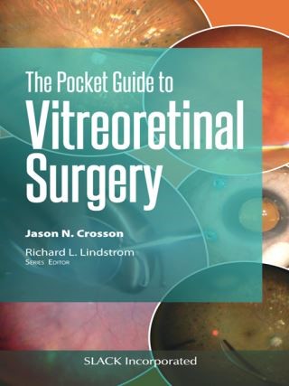 Pocket Guide to Vitreoretinal Surgery Cover Image